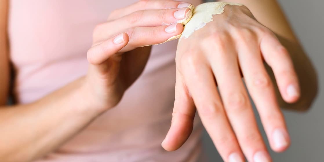 Cover Image for Home Remedies for Mild Burns in Fort Lauderdale